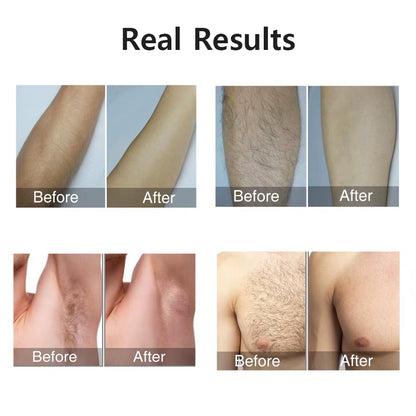 Revolutionary IPL Laser Hair Removal Device - 999,999 Flashes for Effortless and Permanent Hair Removal on Body and Bikini Area