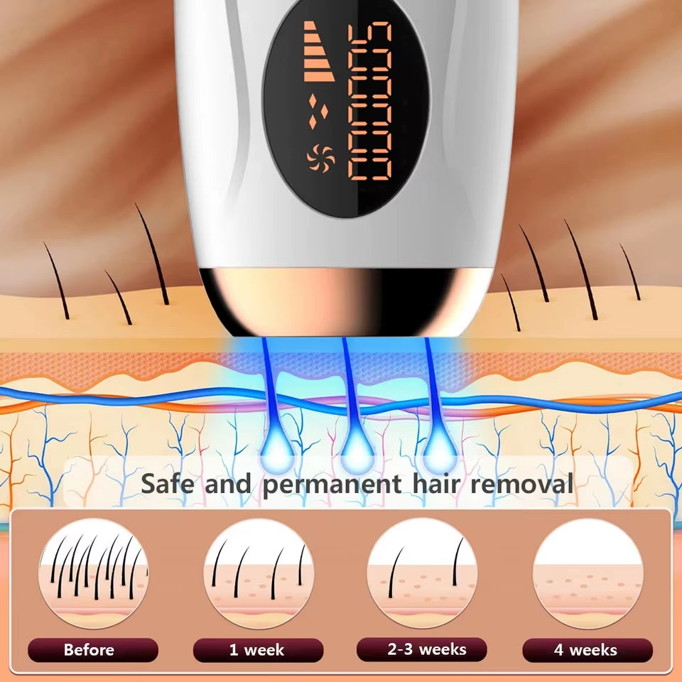 Revolutionary IPL Laser Hair Removal Device - 999,999 Flashes for Effortless and Permanent Hair Removal on Body and Bikini Area